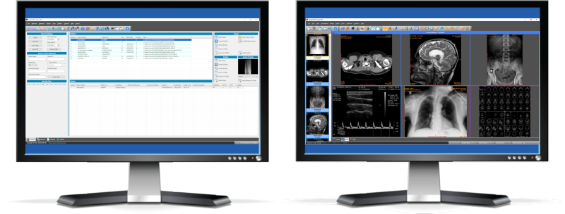 Sante PACS Server PG 2025